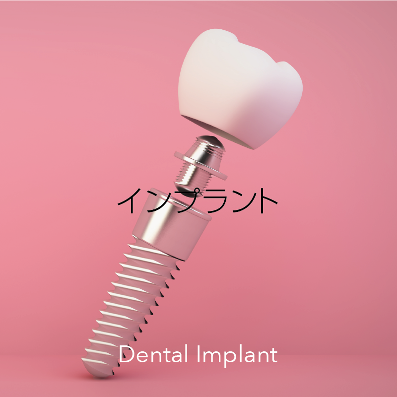 インプラントイメージ